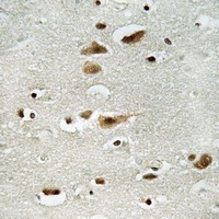 Anti-ERK1/2 (Phospho-Y204) Antibody