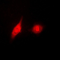 Anti-ERK1/2 (Phospho-Y204) Antibody