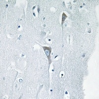 JNK1/2/3 (pY185) antibody