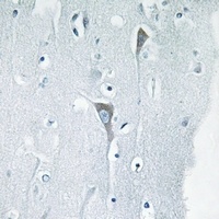 Anti-JNK1/2/3 (Phospho-Y185) Antibody