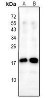 Alpha-synuclein (Phospho-Y136) Antibody
