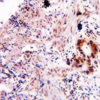 Alpha-synuclein (Phospho-Y136) Antibody