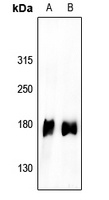EGFR (Phospho-Y1110) Antibody