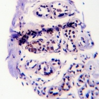 EGFR (pY1110) antibody