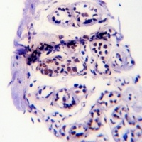 EGFR (Phospho-Y1110) Antibody