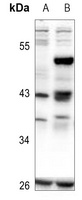 CREB (Phospho-S111) Antibody