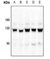Focal Adhesion Kinase (Phospho-S843) Antibody