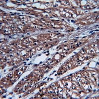 Focal Adhesion Kinase (Phospho-S843) Antibody