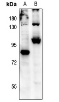 FOXO3 (Phospho-S315) Antibody