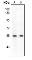 ETS1 (Phospho-S282) Antibody