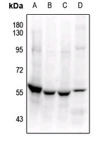 MEF2C Rabbit Polyclonal Antibody