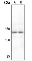 TIE2 Antibody