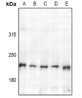 TSC2 Rabbit Polyclonal Antibody