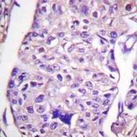 TSC2 Rabbit Polyclonal Antibody