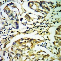 PAK4/5 antibody