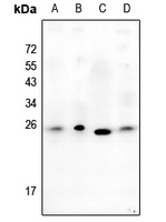Alpha-crystallin B Rabbit Polyclonal Antibody
