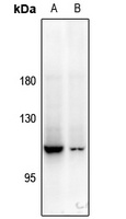 PYK2 Rabbit Polyclonal Antibody