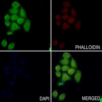 Anti-PYK2 Antibody