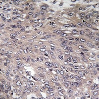 IP3R antibody