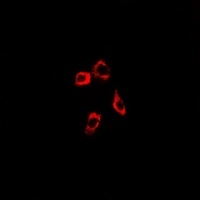 Anti-IP3R Antibody