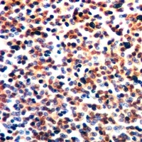 Anti-AHNAK Antibody