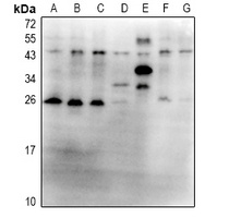 Ubiquitin Rabbit Polyclonal Antibody