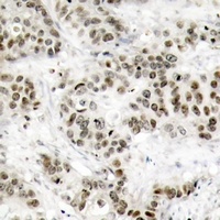 JNK1/2/3 Antibody