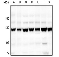 Focal Adhesion Kinase Rabbit Polyclonal Antibody