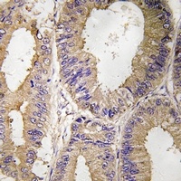 Focal Adhesion Kinase Rabbit Polyclonal Antibody