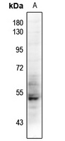TAU Rabbit Polyclonal Antibody