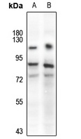 TAU Rabbit Polyclonal Antibody