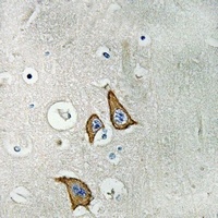 TAU Rabbit Polyclonal Antibody
