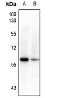 BRK Rabbit Polyclonal Antibody