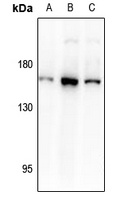 DAP Kinase 1 Antibody