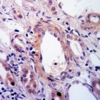 DAP Kinase 1 Antibody