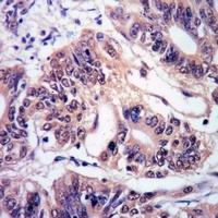 Anti-c-FER Antibody
