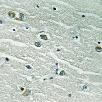 Anti-MERTK/TYRO3 Antibody