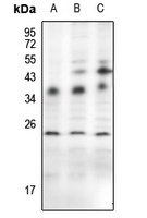 Von Hippel Lindau Rabbit Polyclonal Antibody