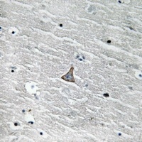 Von Hippel Lindau Rabbit Polyclonal Antibody