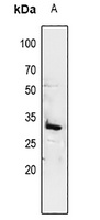 14-3-3 sigma Rabbit Polyclonal Antibody