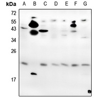 VEGF165 Antibody