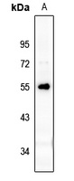 XRCC4 Rabbit Polyclonal Antibody