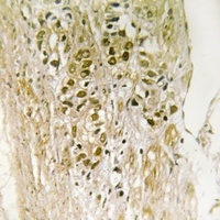 PDZD2 Antibody