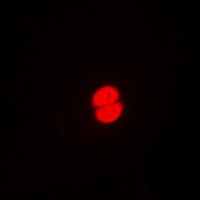 PDZD2 Antibody