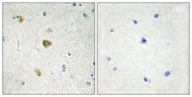 Anti-NDUFC2 Antibody