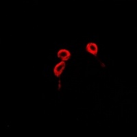 Anti-BLCAP Antibody