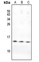 PKI beta Rabbit Polyclonal Antibody