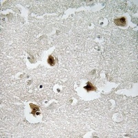 PKI beta Rabbit Polyclonal Antibody