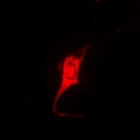 PKI beta Rabbit Polyclonal Antibody