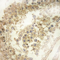 ECRG4 Antibody